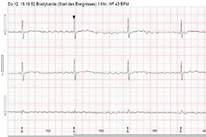 Bild: Langzeit-Elektrokardiogramm